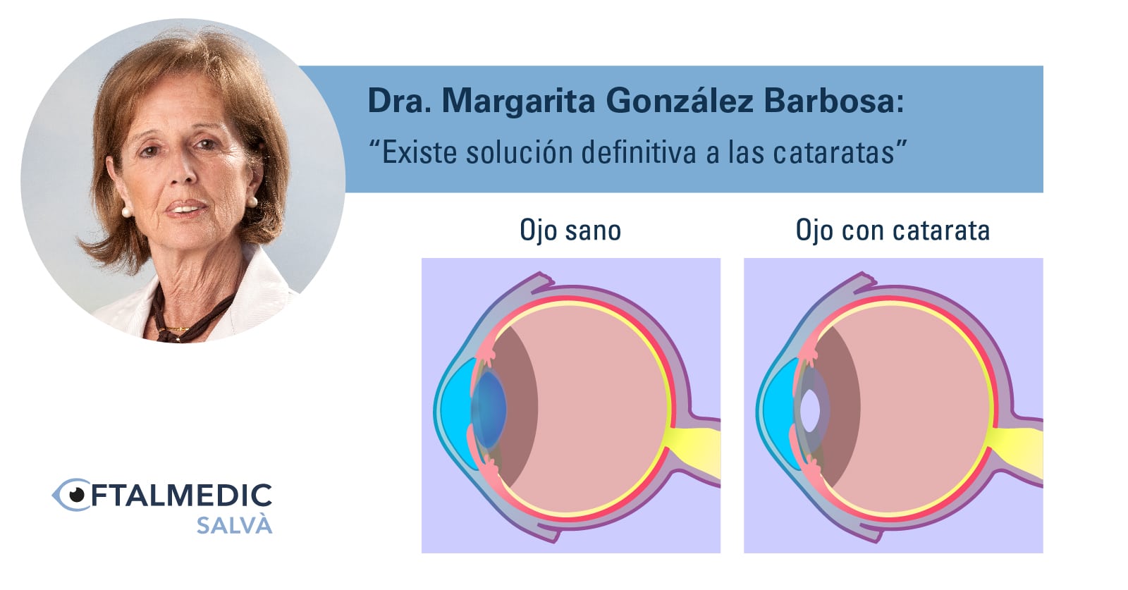 Acabar con las cataratas, por la Dra. Margarita González Barbosa
