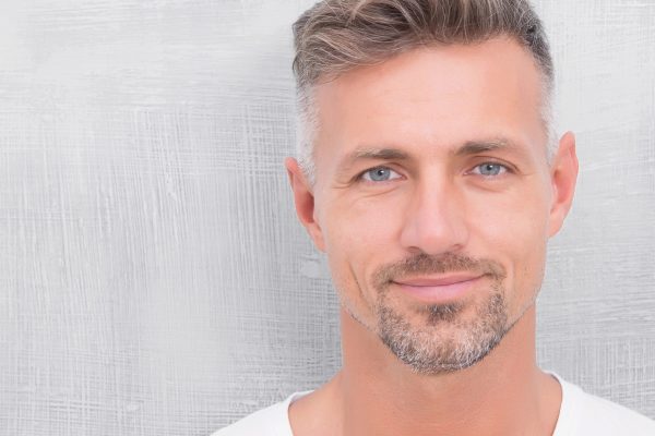 microneedling para rejuvenecer la piel