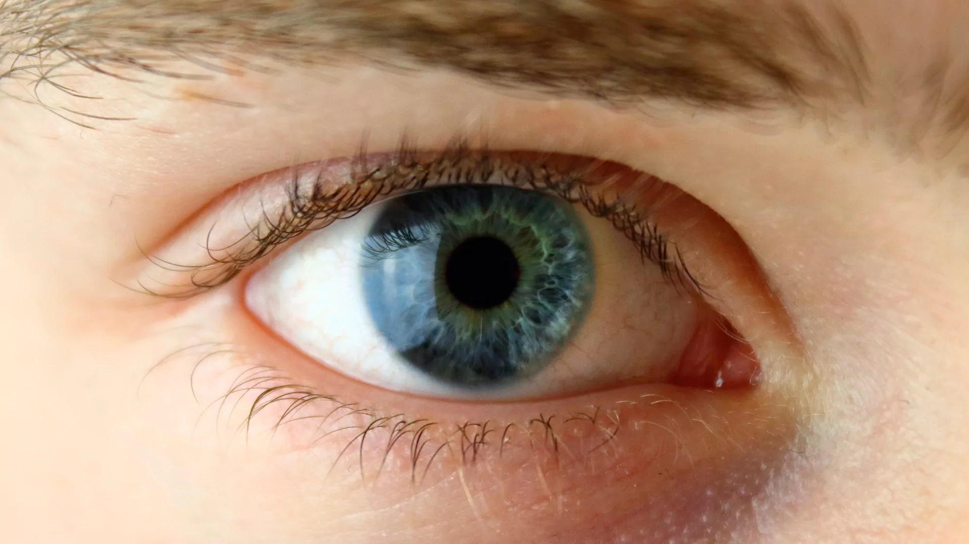 enfermedades de la retina
