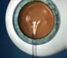Operación con lente intraocular Mallorca